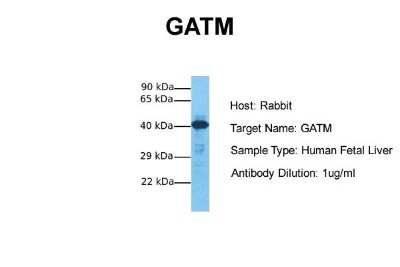 Western Blot: GATM Antibody [NBP1-54764]