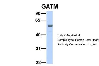 Western Blot: GATM Antibody [NBP1-54764]