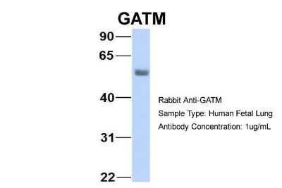 Western Blot: GATM Antibody [NBP1-54764]
