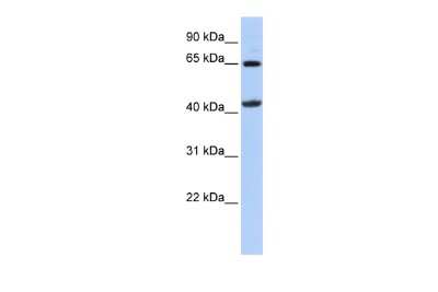 Western Blot: GATM Antibody [NBP1-54764]