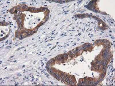 Immunohistochemistry-Paraffin: Cytosolic beta-Glucosidase/GBA3 Antibody (OTI1F1) [NBP2-00521]
