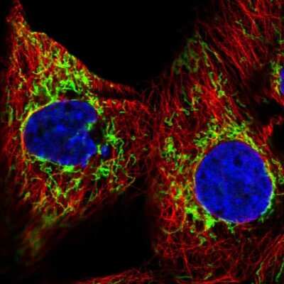 Immunocytochemistry/ Immunofluorescence: GBAS Antibody [NBP2-38984]
