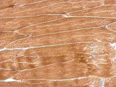 Immunohistochemistry-Paraffin: GBAS Antibody [NBP2-16617]