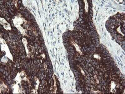 Immunohistochemistry: GBAS Antibody (OTI1B8) - Azide and BSA Free [NBP2-70804]