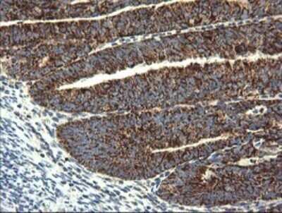 Immunohistochemistry: GBAS Antibody (OTI1B8) - Azide and BSA Free [NBP2-70804]