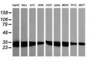 Western Blot: GBAS Antibody (OTI1B8)Azide and BSA Free [NBP2-70804]
