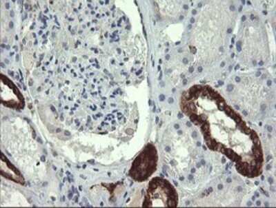 Immunohistochemistry: GBAS Antibody (OTI1B8) [NBP2-45730]