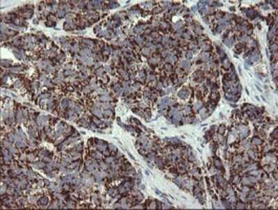 Immunohistochemistry: GBAS Antibody (OTI1B8) [NBP2-45730]