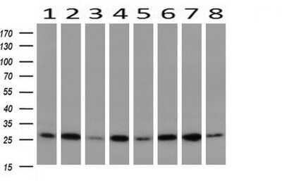 Western Blot: GBAS Antibody (OTI1B8) [NBP2-45730]