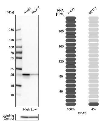Western Blot: GBAS Antibody [NBP2-38984]