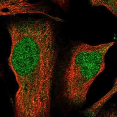 Immunocytochemistry/ Immunofluorescence: GBE1 Antibody [NBP1-85877]