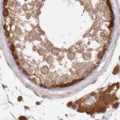 Immunohistochemistry-Paraffin: GBE1 Antibody [NBP1-85876]