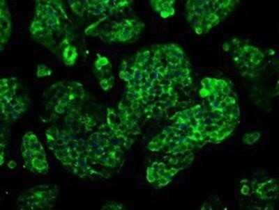Immunocytochemistry/ Immunofluorescence: GBE1 Antibody (OTI1D11) - Azide and BSA Free [NBP2-70810]