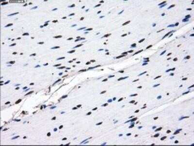 Immunohistochemistry: GBE1 Antibody (OTI1D11) - Azide and BSA Free [NBP2-70810]