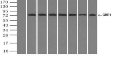 Immunoprecipitation: GBE1 Antibody (OTI1D11) - Azide and BSA Free [NBP2-70810]