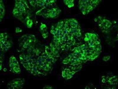 Immunocytochemistry/ Immunofluorescence: GBE1 Antibody (OTI1D11) [NBP2-02245]