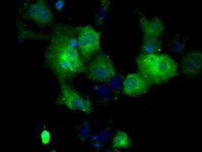 Immunocytochemistry/ Immunofluorescence: GBE1 Antibody (OTI1D11) [NBP2-02245]