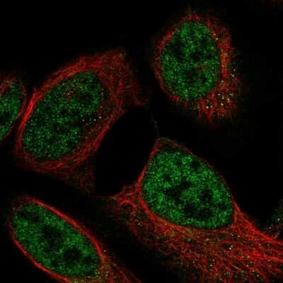 Immunocytochemistry/ Immunofluorescence: GBL Antibody [NBP2-38491]