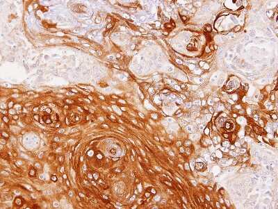 Immunohistochemistry-Paraffin: GBP1 Antibody [NBP1-31560]