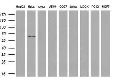 Western Blot: GBP2 Antibody (OTI5C8) [NBP1-47768]
