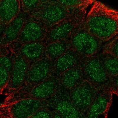 Immunocytochemistry/ Immunofluorescence: GBP2 Antibody [NBP2-48771]