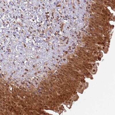 Immunohistochemistry-Paraffin: GBP2 Antibody [NBP2-48771]