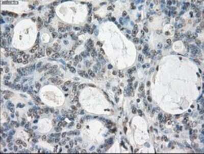 Immunohistochemistry: GBP2 Antibody (OTI5C8) - Azide and BSA Free [NBP2-70812]