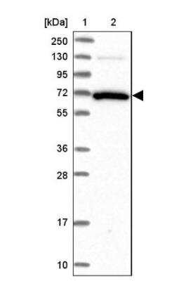 Western Blot: GBP2 Antibody [NBP2-48771]