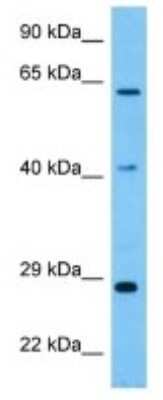 Western Blot: GBP3 Antibody [NBP3-10284]