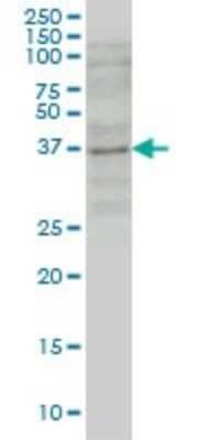 Western Blot: GBX2 Antibody (1A7) [H00002637-M03]