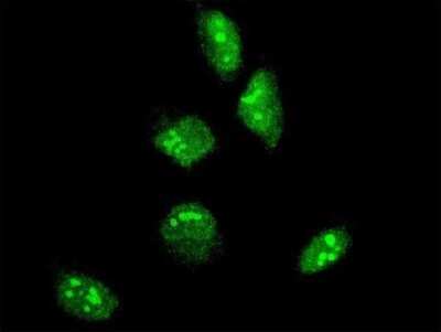 Immunocytochemistry/ Immunofluorescence: GBX2 Antibody (1C11) [H00002637-M04]