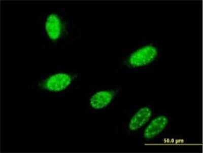 Immunocytochemistry/ Immunofluorescence: GBX2 Antibody (2A4) [H00002637-M01]