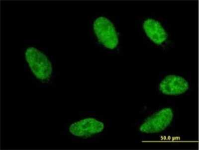 Immunocytochemistry/ Immunofluorescence: GBX2 Antibody (2D8) [H00002637-M02]