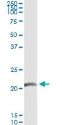 Immunoprecipitation: GCAP3 Antibody (3F10) [H00009626-M03]