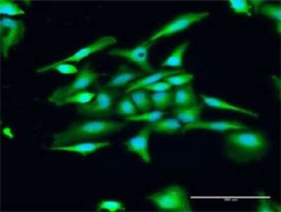 Immunocytochemistry/ Immunofluorescence: GCAP3 Antibody [H00009626-D01P]