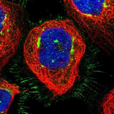 Immunocytochemistry/ Immunofluorescence: GCC1 Antibody [NBP1-83610]