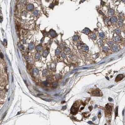 Immunohistochemistry-Paraffin: GCC1 Antibody [NBP1-83609]