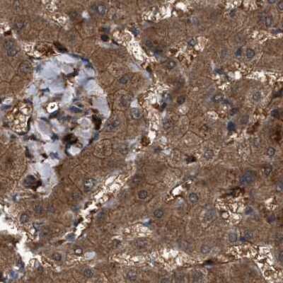 Immunohistochemistry-Paraffin: GCC1 Antibody [NBP1-83609]