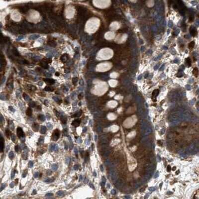 Immunohistochemistry-Paraffin: GCC1 Antibody [NBP1-83609]