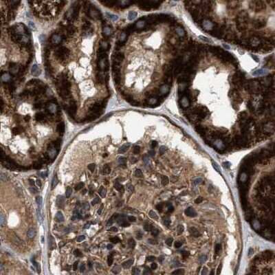 Immunohistochemistry-Paraffin: GCC1 Antibody [NBP1-83609]