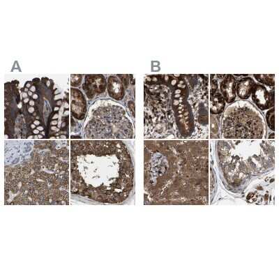 Immunohistochemistry-Paraffin: GCC1 Antibody [NBP1-83610]