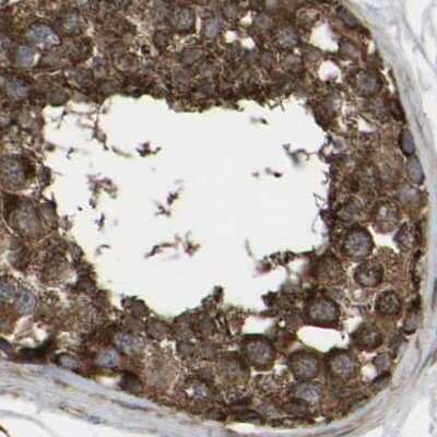 Immunohistochemistry-Paraffin: GCC1 Antibody [NBP1-83610]
