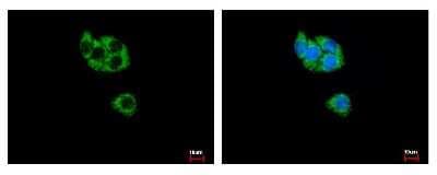 Immunocytochemistry/ Immunofluorescence: GCDH Antibody [NBP2-16622]