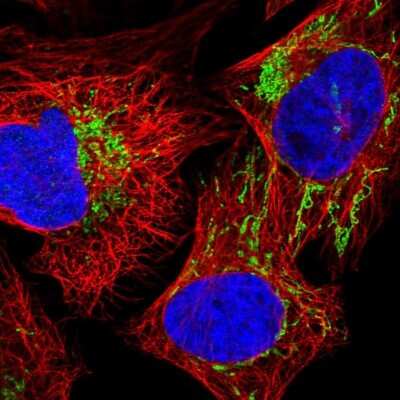 Immunocytochemistry/ Immunofluorescence: GCDH Antibody [NBP2-48549]
