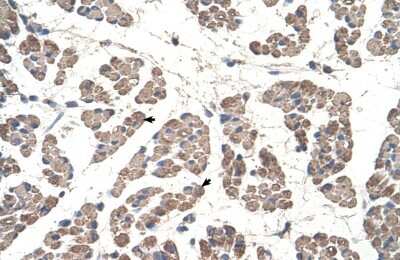 Immunohistochemistry-Paraffin: GCDH Antibody [NBP1-54737]