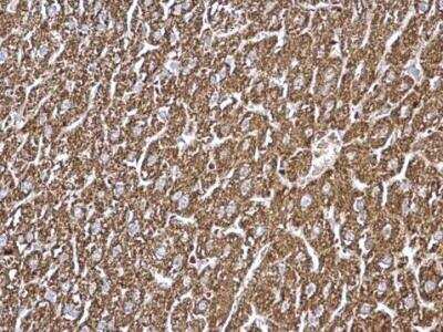 Immunohistochemistry-Paraffin: GCDH Antibody [NBP2-16622]