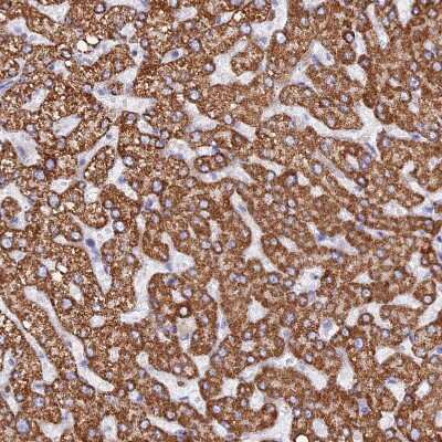 Immunohistochemistry-Paraffin: GCDH Antibody [NBP2-48549]