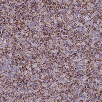 Immunohistochemistry-Paraffin: GCDH Antibody [NBP2-48549]
