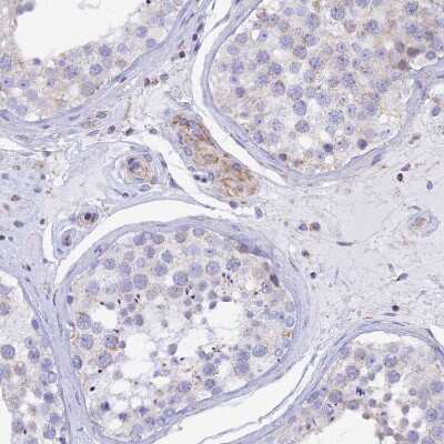 Immunohistochemistry-Paraffin: GCDH Antibody [NBP2-48549]