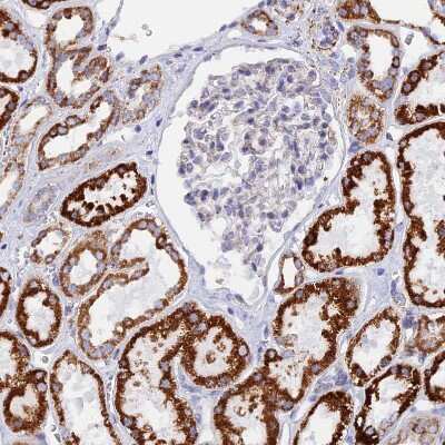 Immunohistochemistry-Paraffin: GCDH Antibody [NBP2-48549]
